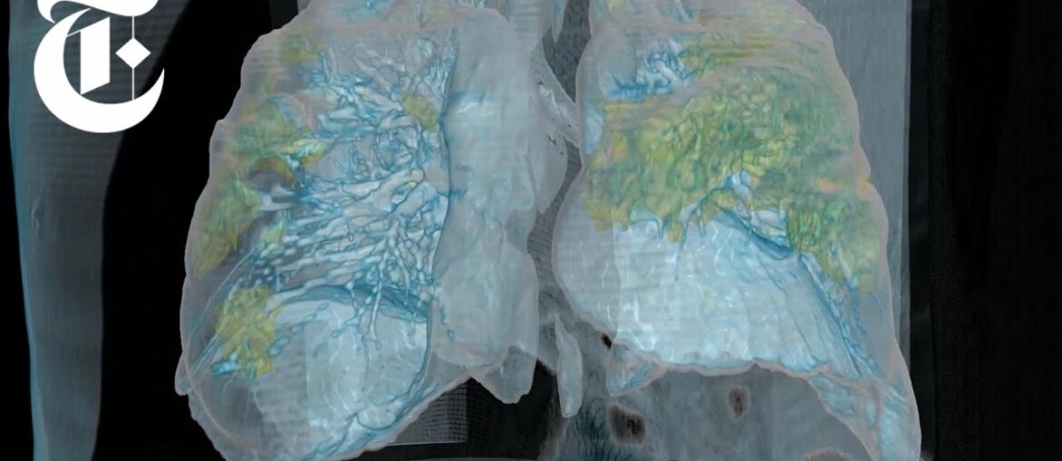 How Coronavirus Attacks the Body | NYT News