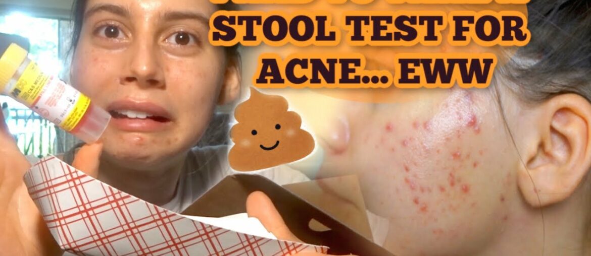 I HAD TO TAKE A STOOL TEST FOR MY ACNE!?!?  MY REACTION, THE PROCESS AND EXPERIENCE....