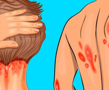 10 Zeichen, die deutlich für Vitamin-D-Mangel sprechen