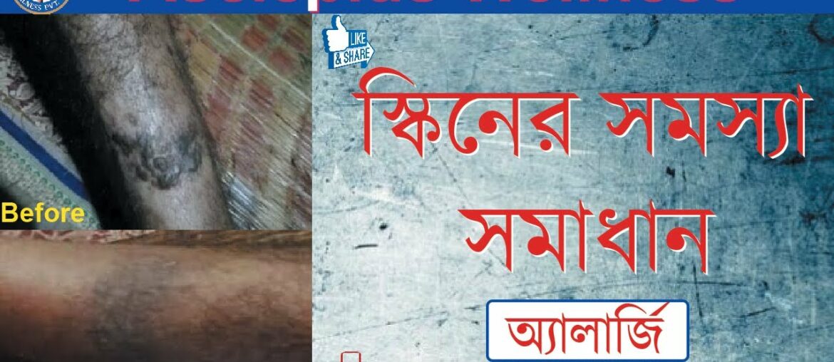 স্কিনের সমস্যা | সমাধান | Skin disease problem | solved by awpl | ayurvedic medicine