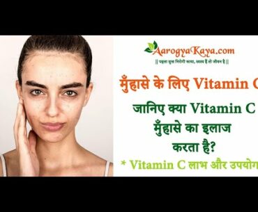 Skin Care Tips | Does Vitamin C Treat Acne | Vitamin C Benefits and Uses In Hindi | AarogyaKaya.com