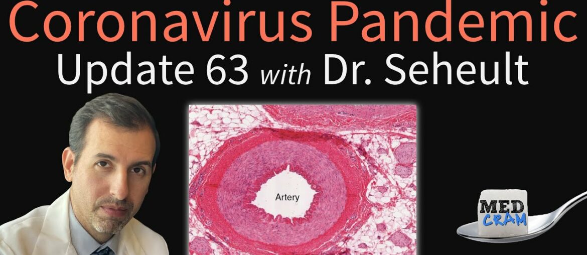 Coronavirus Pandemic Update 63: Is COVID-19 a Disease of the Endothelium (Blood Vessels and Clots)?