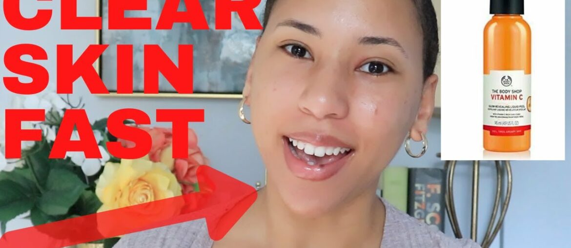 HOW TO GET RID OF ACNE IN ONE DAY| How to Get Clear Skin Instantly| Glowy Skin| Clear Skin Fast|
