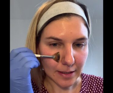 Glow Peel with Vitamin A Boost