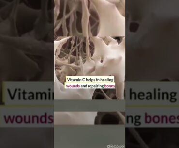 NUTRITION: 7 Impressive Ways Vitamin C Benefits Your Body