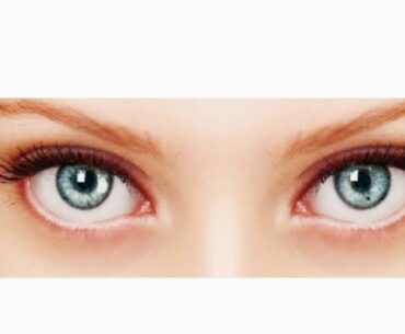 Vitamin A Agung setioaji alkhaliq 1903036010