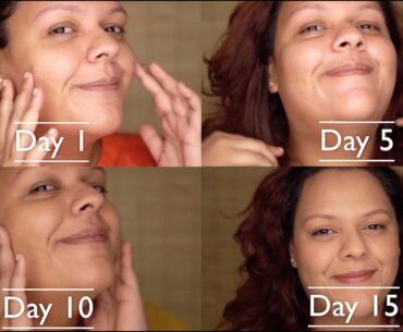 Vitamin C Skin Lightening Gel | Blossom Kochhar Aroma Magic