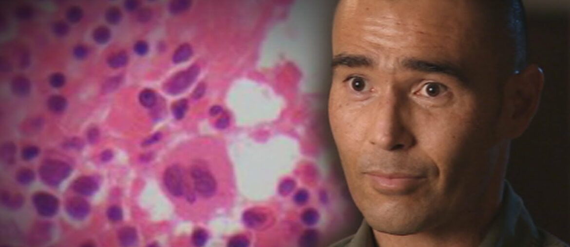 Vitamin C for cancer? ‘Miracle man’ Anton Kuraia's highly controversial treatment