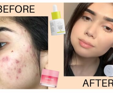 Night Time Skincare Routine