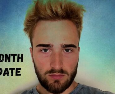 Finasteride 7 Month Update