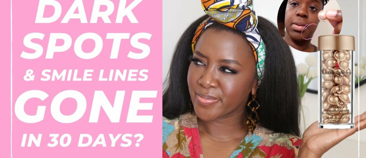 Hyperpigmentation/Dark Spots  + Smile Lines GONE in 30 Days? Elizabeth Arden Vitamin C Benefits