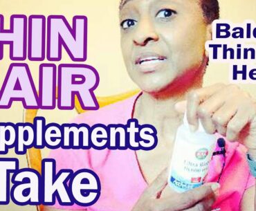 Thinning & Balding - My Supplement Regime / TV Blake Review