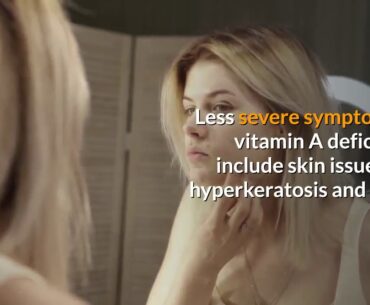 vitamin a benefits deficiency toxicity and more