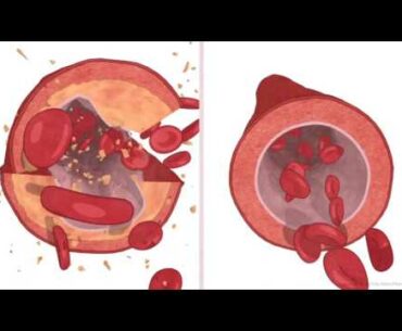 How to Keep Your Arteries Healthy | Vitamin K2 | Essential Nutrition | Product Overview