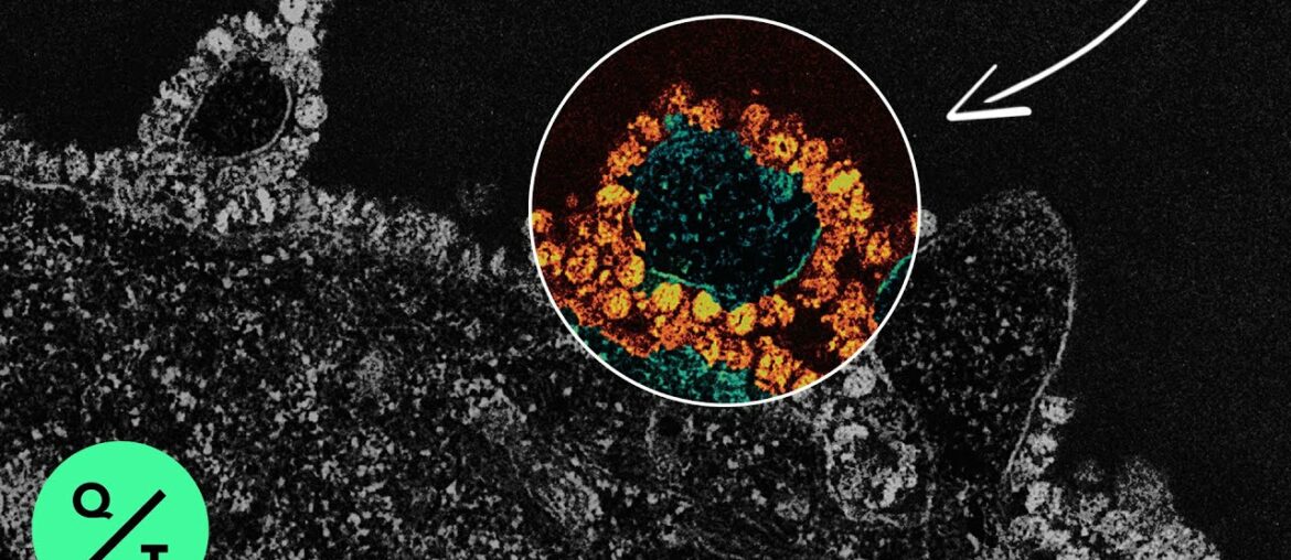 How the Coronavirus Hijacks Your Cells