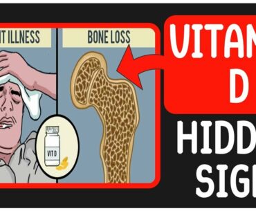 कैसे करें Vitamin D की कमी पूरी (Vitamin D Deficiency, Foods, Supplement)