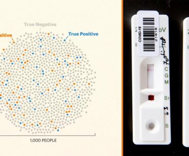 Why You Can’t Always Trust Your Coronavirus Antibody Test Results