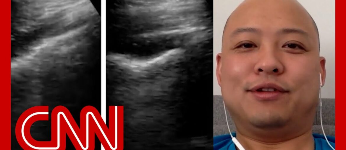 Doctor ultrasounds his lungs as his coronavirus progresses