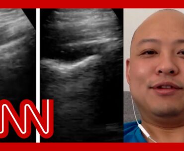 Doctor ultrasounds his lungs as his coronavirus progresses