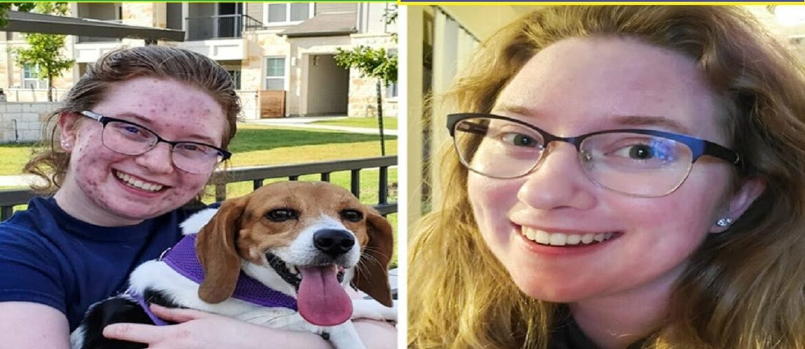 Benifits Of Vitamin C For Skin | Skin Health | Skin Beauty | Beauty Tips | How To Become Beautiful