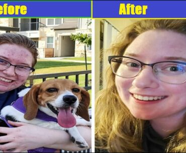 Benifits Of Vitamin C For Skin | Skin Health | Skin Beauty | Beauty Tips | How To Become Beautiful