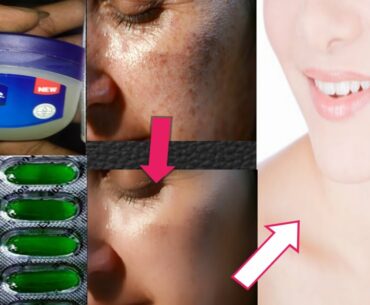 vaseline  and Vitamin E capsule Natural Beauty Tips // Get white skin
