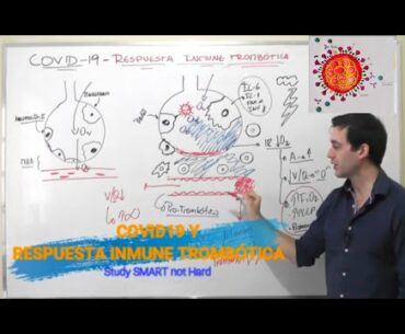 COVID19  Y RESPUESTA INMUNE TROMBÓTICA