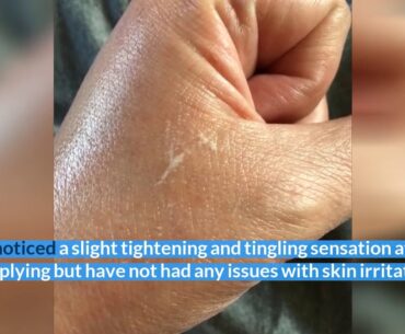 Peptides - Belei Vitamin C + Hyaluronic Acid Serum, Fragrance Free, Paraben Free, 1 Fluid Ounce...