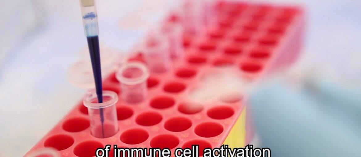 Hebrew University: Limiting Immune Cell Activation to Fight COVID-19