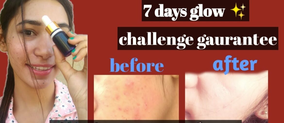 7 days glow challenge guarantee || vitamin C serum at home