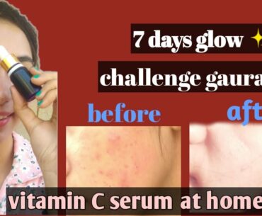 7 days glow challenge guarantee || vitamin C serum at home