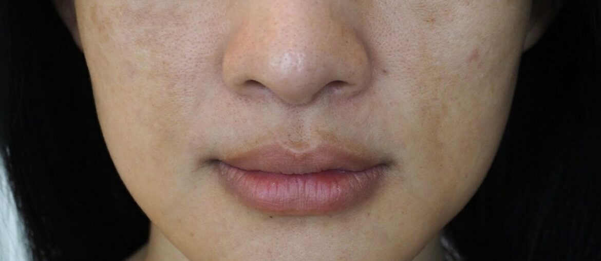 10 Early Signs Your Body Is Running Out of Vitamin C