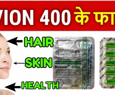 EVION 400 :Vitamin E के Capsule रोज खाने से होंगे चौकाने वाले फायदे: BENEFITS OF VITAMIN E