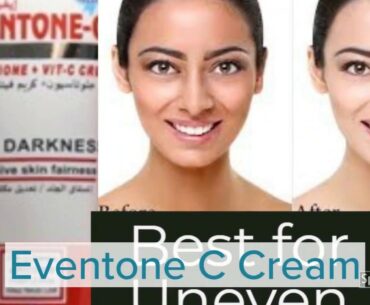 Reality of Best Medicated Skin Whitening Glutathione Vitamin C cream-Eventone C .. Yess or No ?