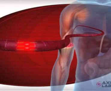 How does Creatine work? | Axis Labs