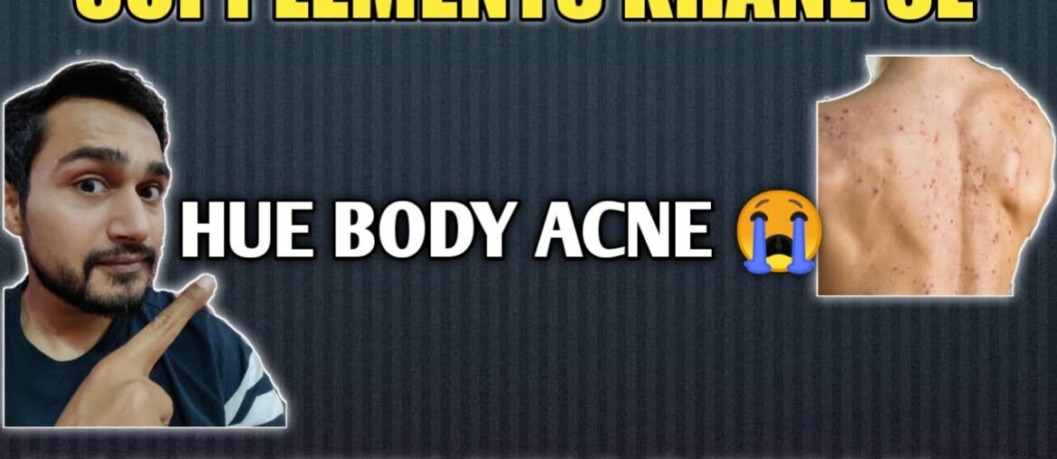Supplements se hue body acne kaise honge thik | side effects of fake supplements | supplements villa
