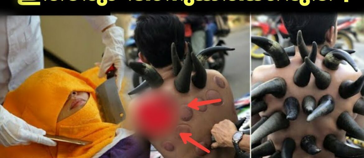 നിങ്ങളറിയാത്ത ചില കാര്യങ്ങൾ!  കണ്ടാൽ സഹിക്കില്ല 😱 | DIFFERENT TYPES OF THERAPY'S | MALAYALAM |