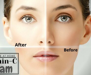 Apply Vitamin-C Night Cream | Remove Wrinkles | Skin Whitening Serum | 100% Natural | DIY | By - ABW