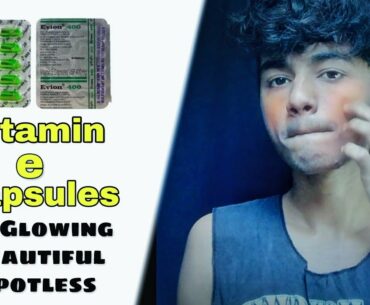 Vitamin E Capsules, For Glowing Skin, Beautiful, Spotless,