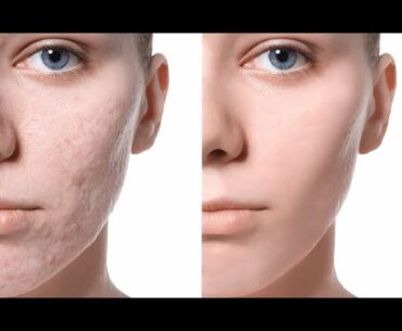 I tried DIY Vitamin C toner by Beauty Recipes...!!