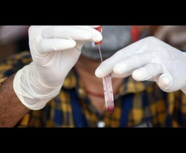 Low Vitamin D with a High COVID 19 Death Rate