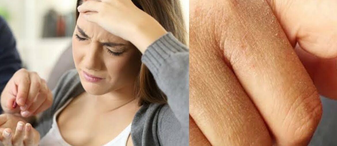 These can be the signs of Vitamin A deficiency| Vitamin A deficiency causes| Health issues