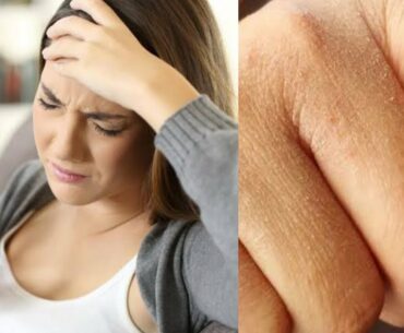 These can be the signs of Vitamin A deficiency| Vitamin A deficiency causes| Health issues