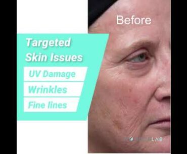 NO FACE Vitamin C for Brightening, Hyperpigmentation & Clear Skin