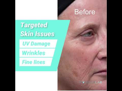 NO FACE Vitamin C for Brightening, Hyperpigmentation & Clear Skin