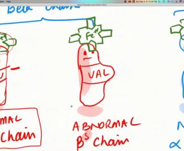 COVID-19 Insights: Sickle Cell and Thalassemia