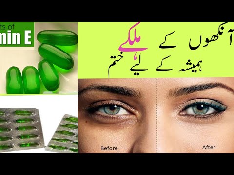 Remove Dark Circles in 5 days with Vitamin- E (100% Works)