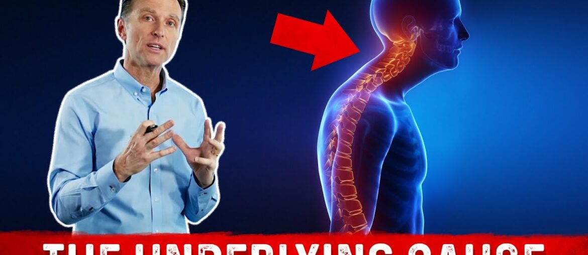 Scoliosis, Kyphosis, Lordosis and Vitamin D