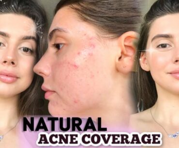 HOW TO COVER UP ACNE NATURALLY W/ MAKEUP || GOLDEN HOUR with acne Tutorial , UPDATED MAKEUP ROUTINE!