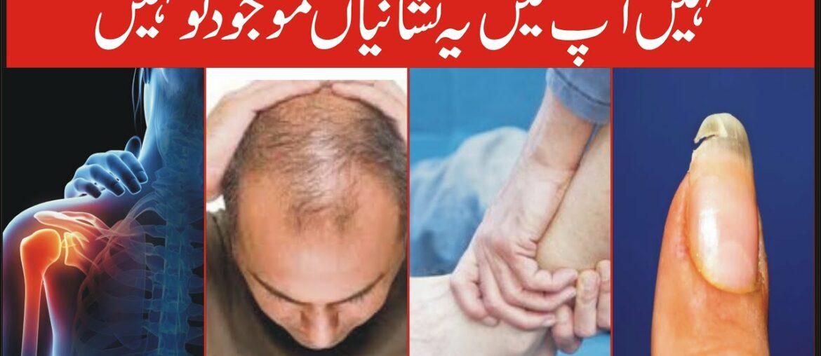 Vitamin Ki Kami Ka ilaj in Urdu  / Vitamin Ki Kami Ki Alamat in Hindi / Jismani Kamzori Ka Desi ilaj